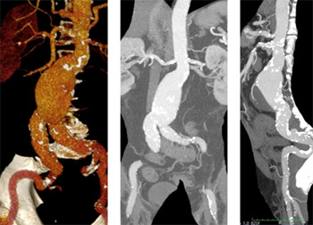 Patient Male, 70 Y (K.W.) 