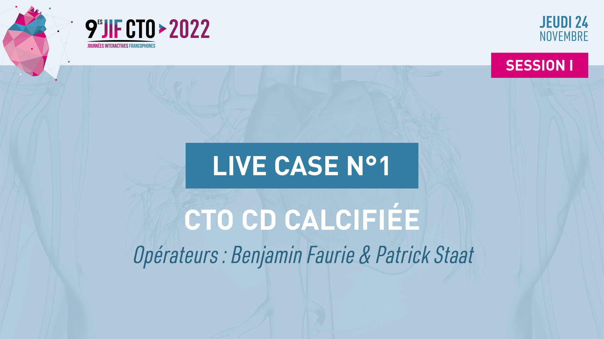 Live Case #3 - Occlusion au trépied de la CD