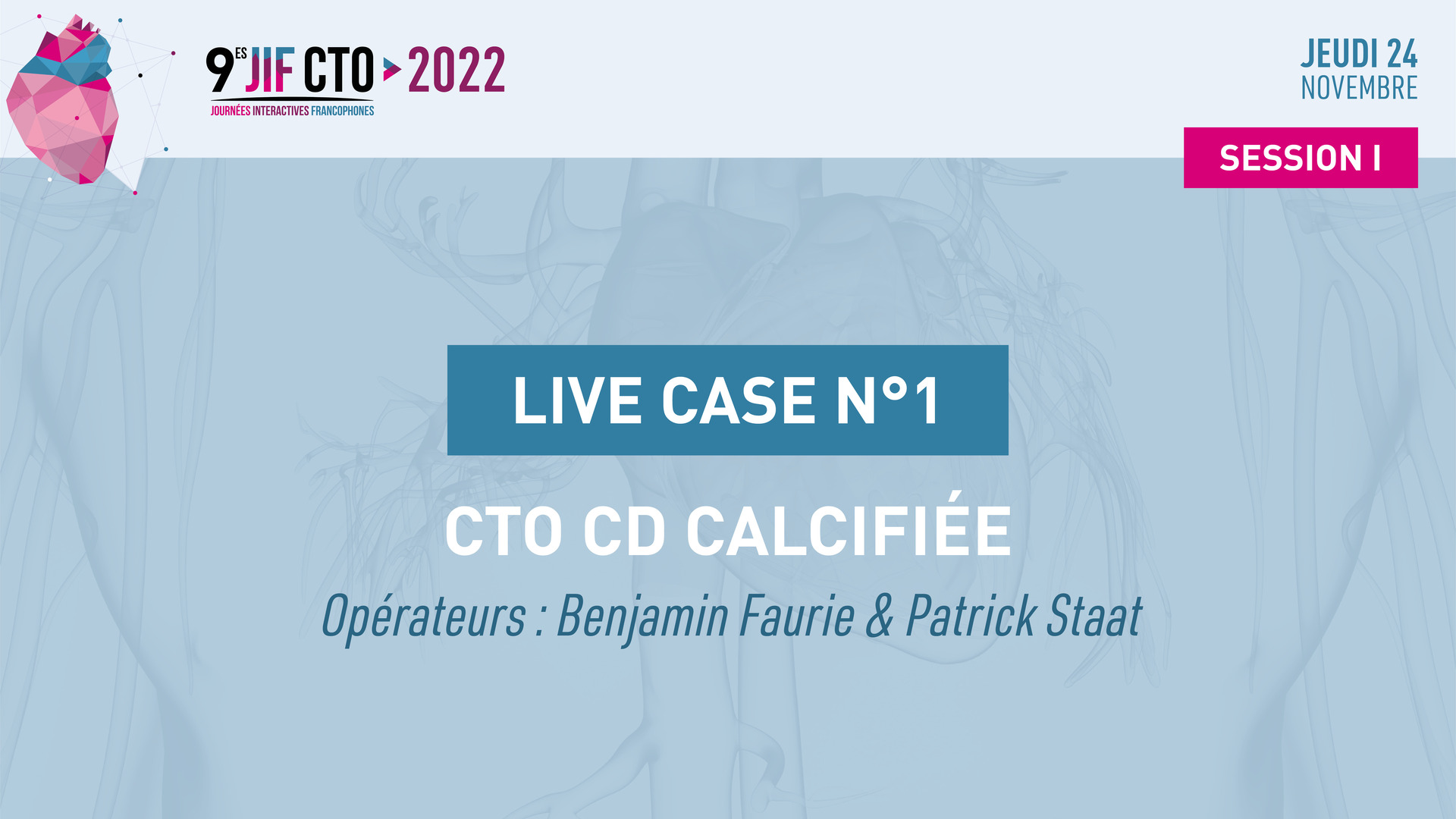 Live Case #9 - Occlusion marginale avec Echec épicardique