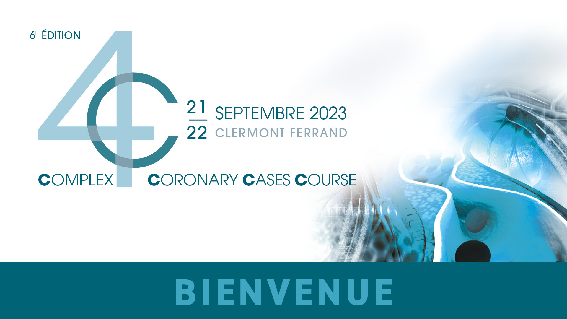 Live case #4 : Bifurcation en live sous OCT