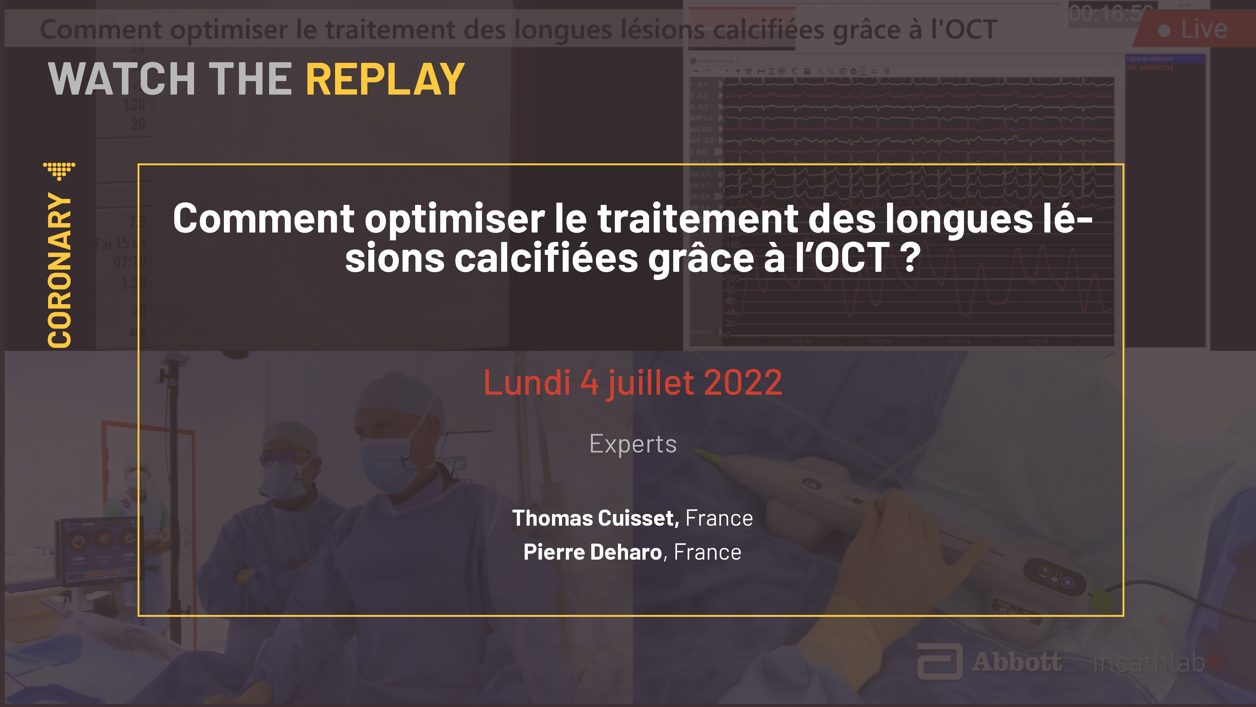 Comment optimiser le traitement des longues lésions calcifiées grâce à l’OCT ?