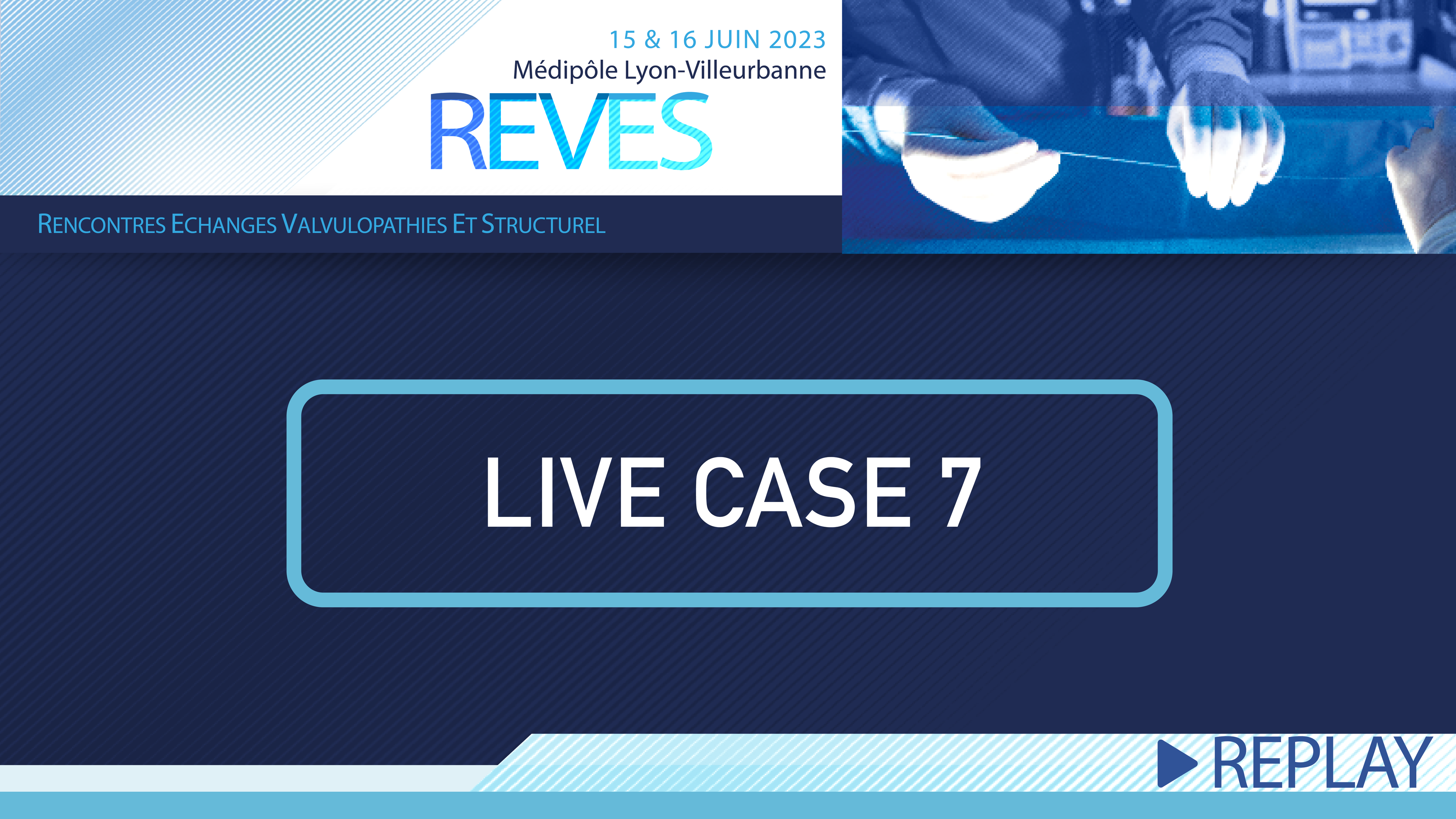 REVES : Live Case 7 - TAVIV