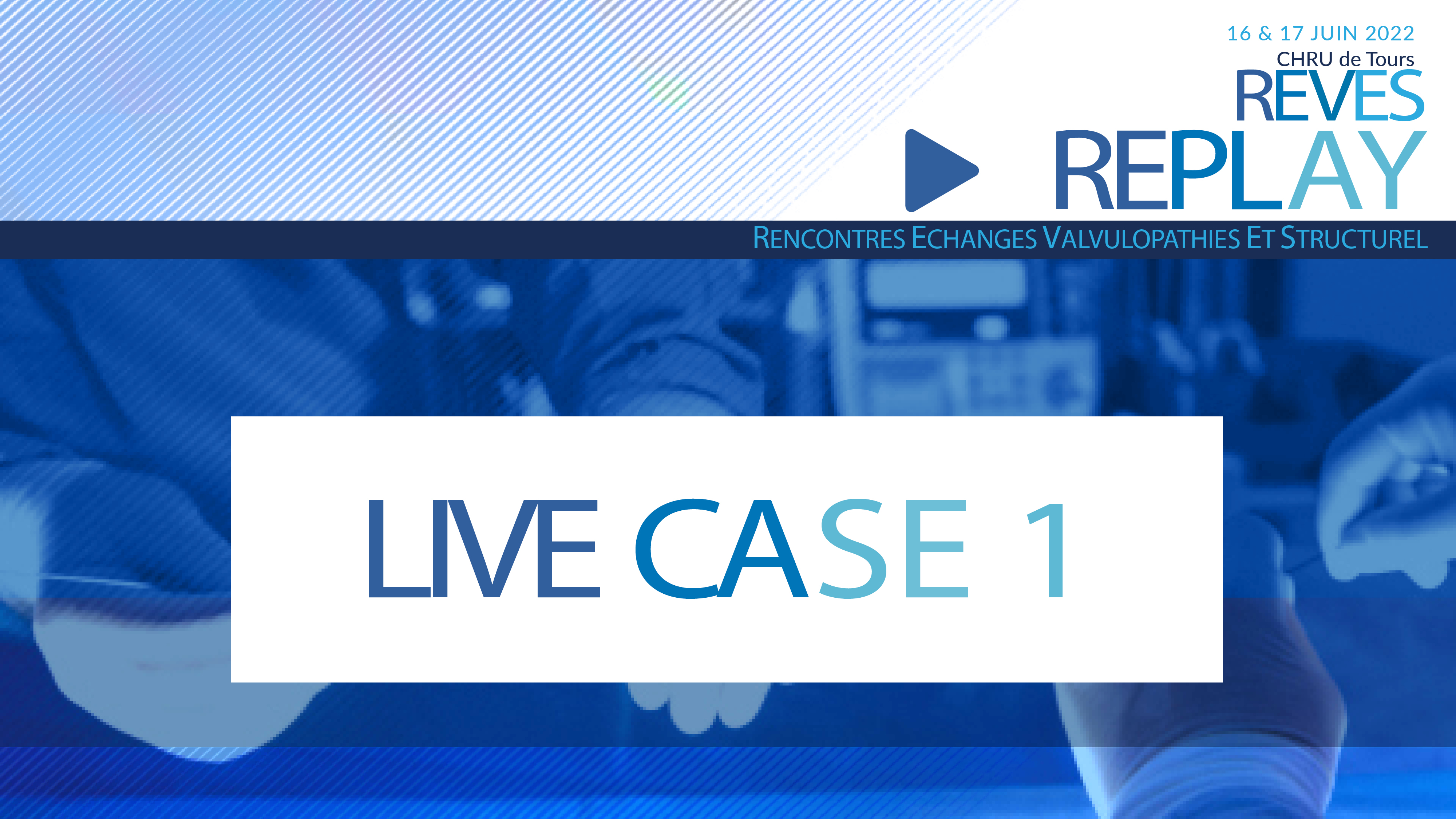 REVES: Live Case 7