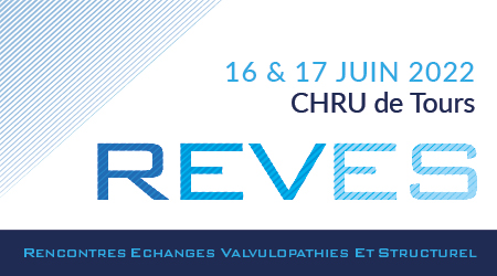 REVES: SESSION 6