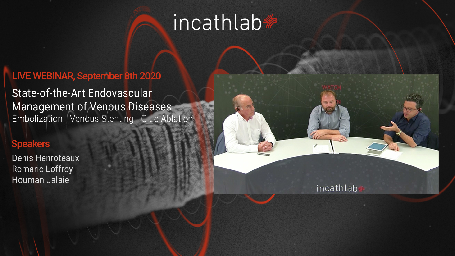 State-of-the-Art Endovascular Management of Venous Diseases