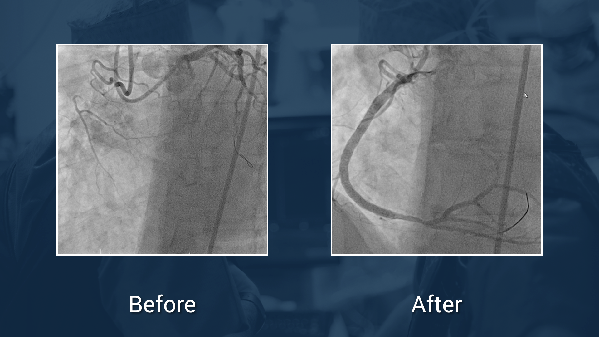 Resolute Onyx <span class="separator">/</span> <span class="labname">Medtronic</span>