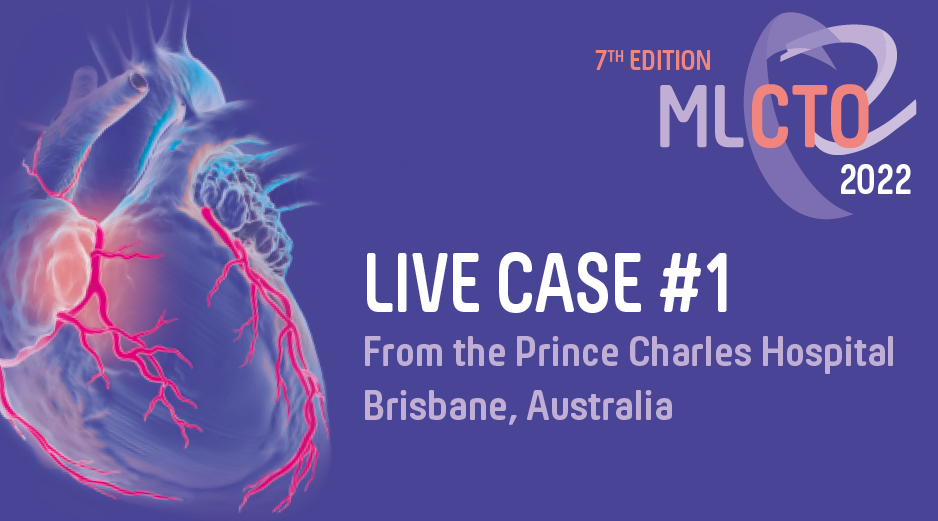 Live Case #2