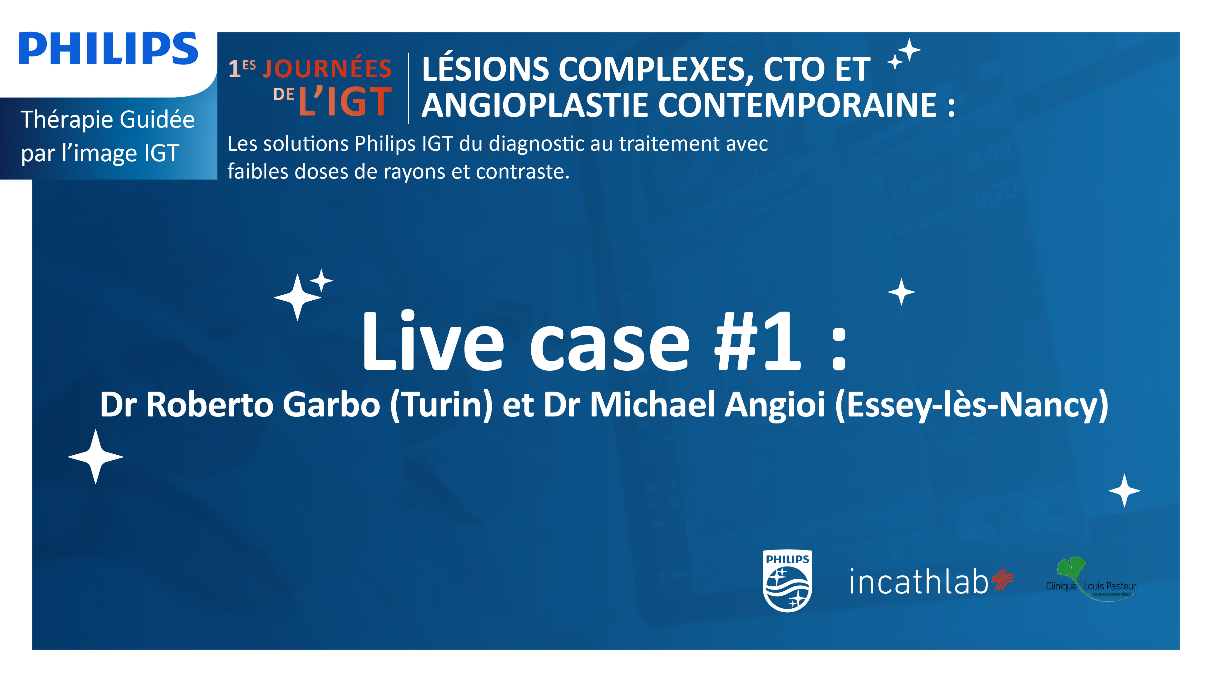Philips IGT - Live Case 1