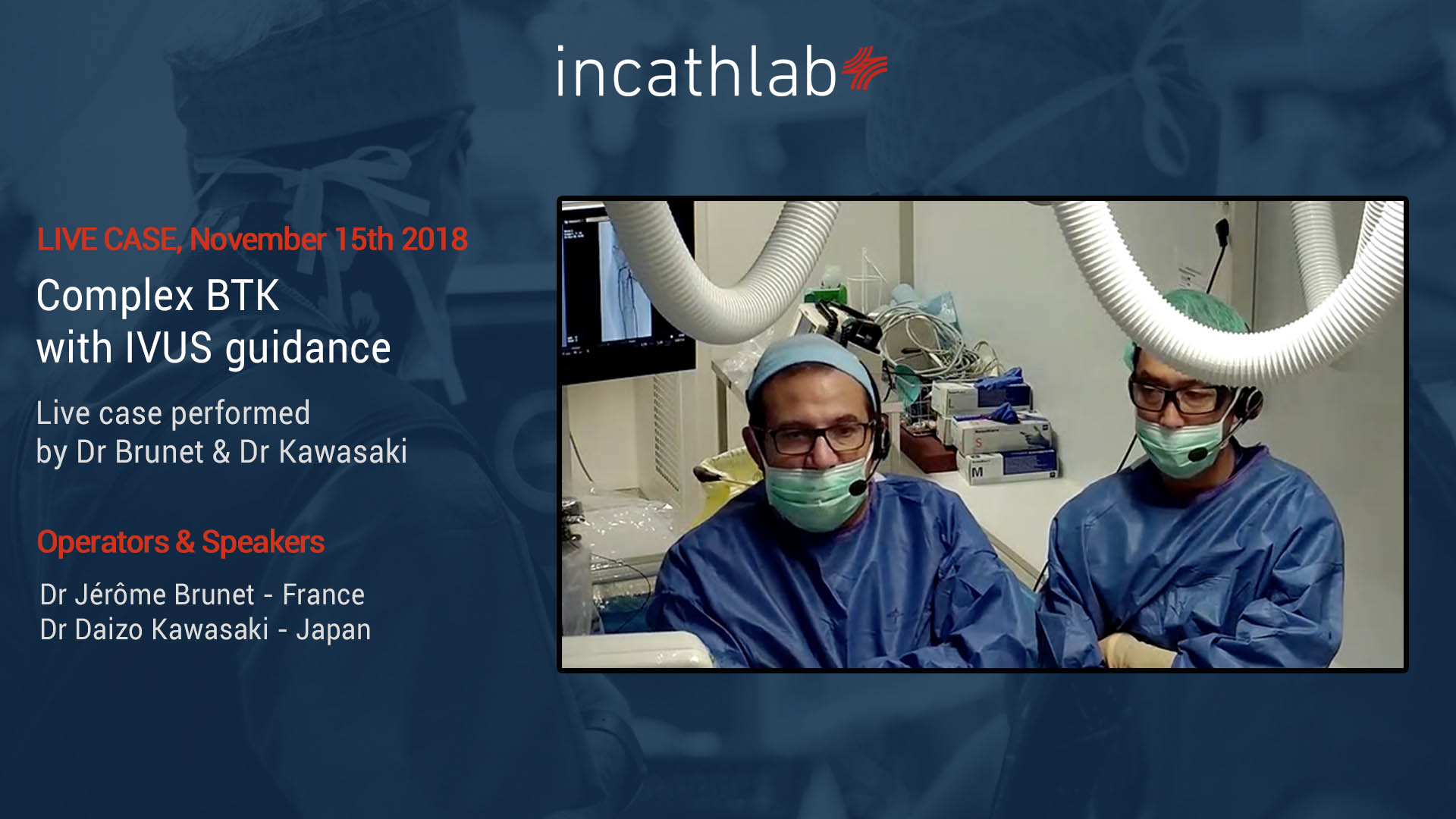 Live Case: Long SFA lesion treated according to ALARAS- and REACT strategies