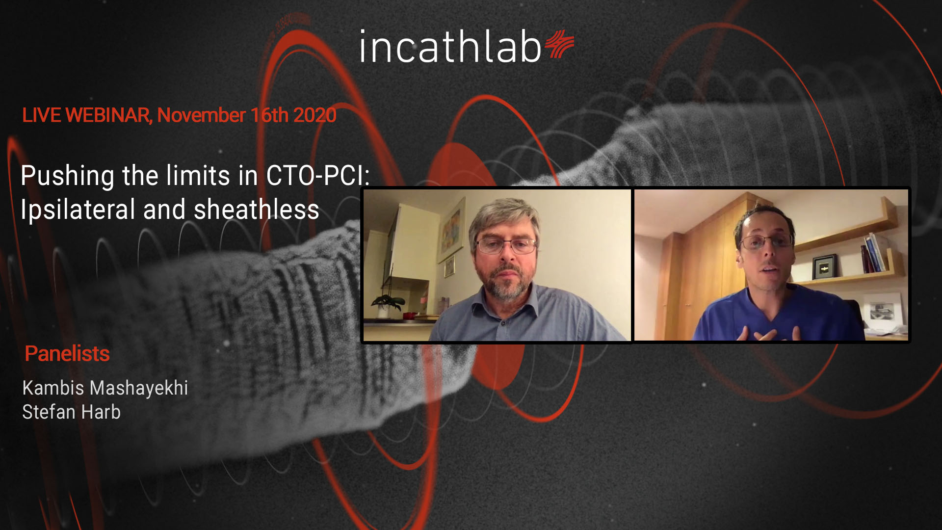 Pushing the limits in CTO-PCI: Ipsilateral and sheathless