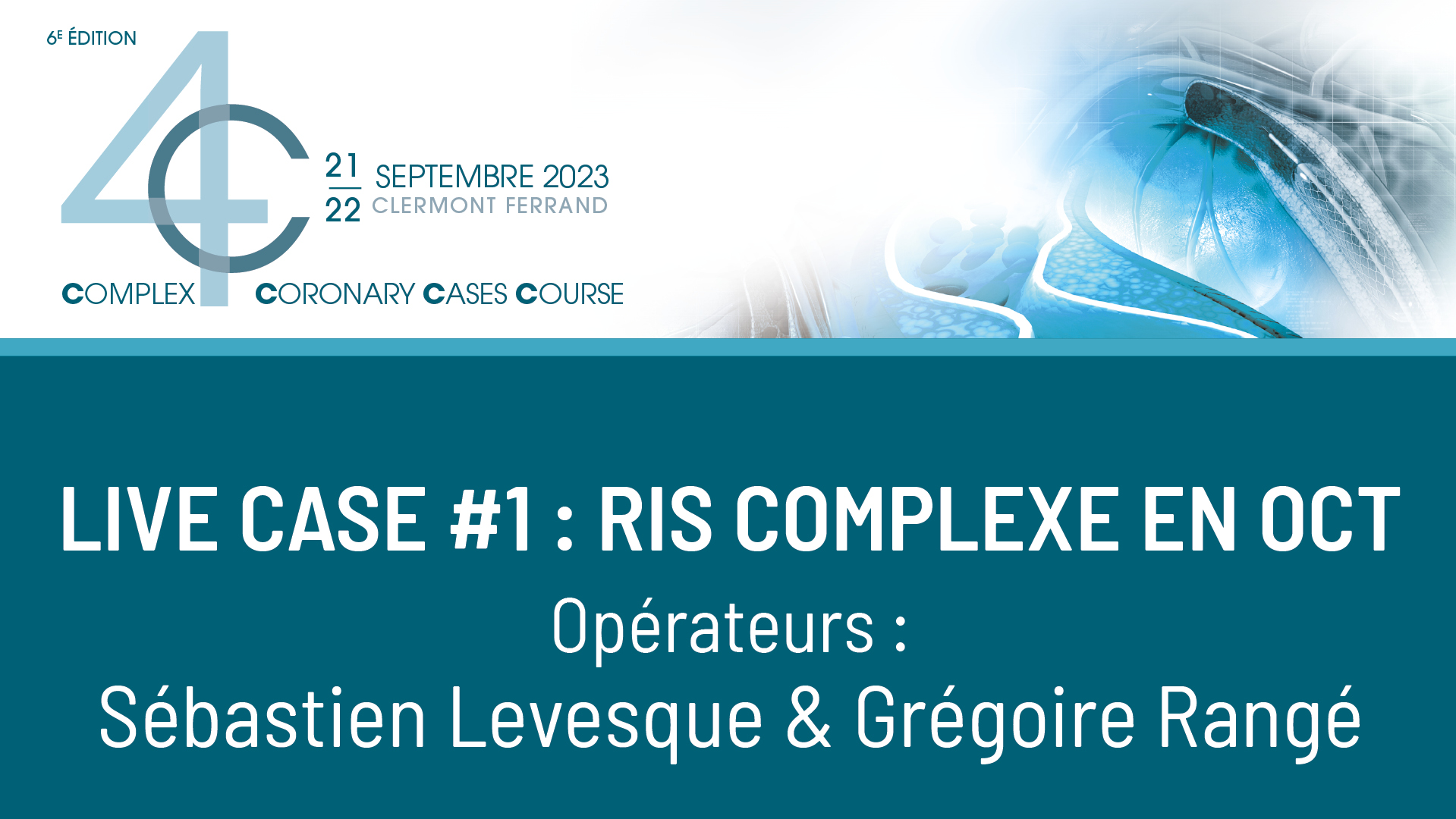 Live case #1 : RIS complexe en OCT