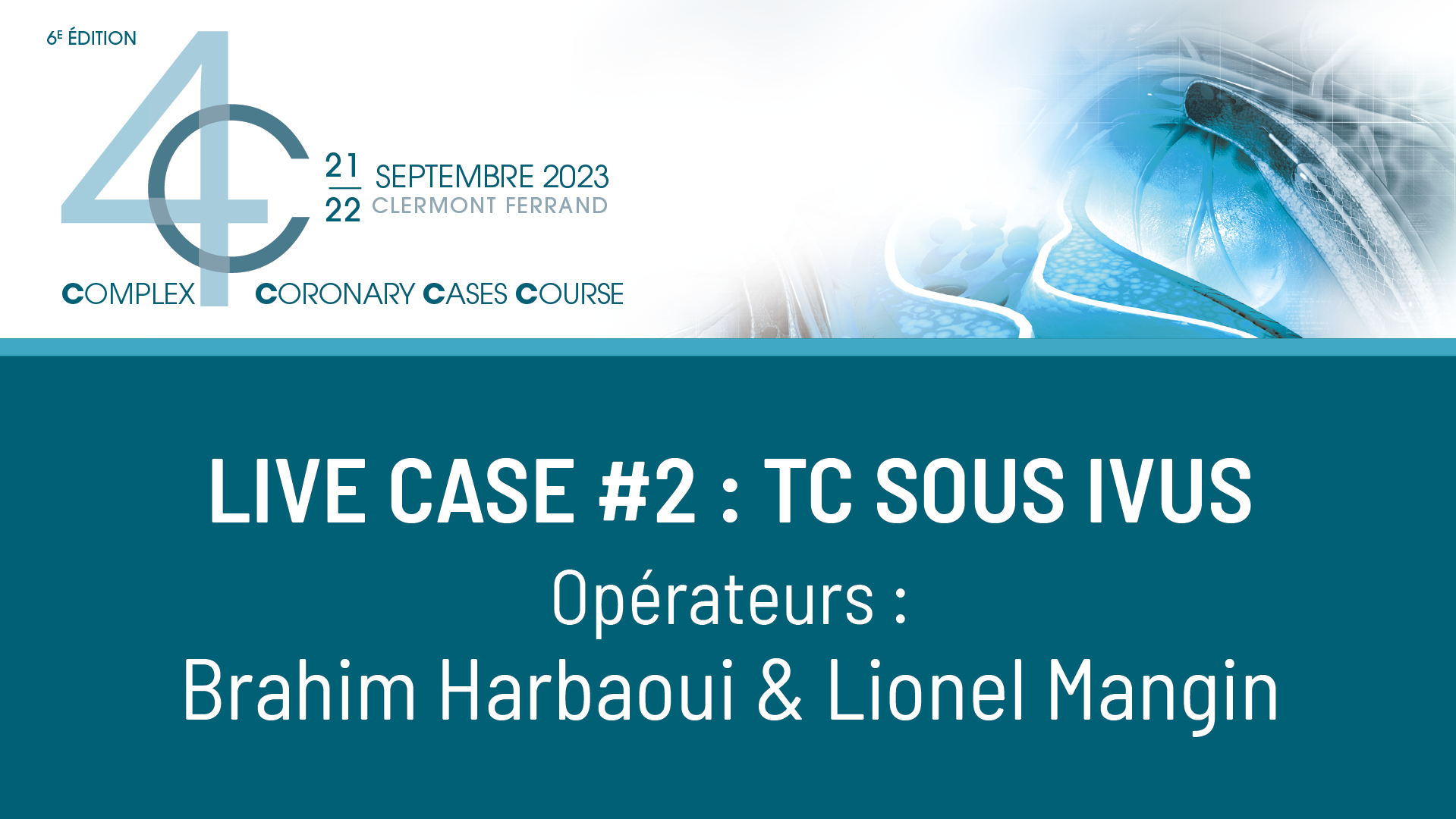Live case #2 : TC sous IVUS