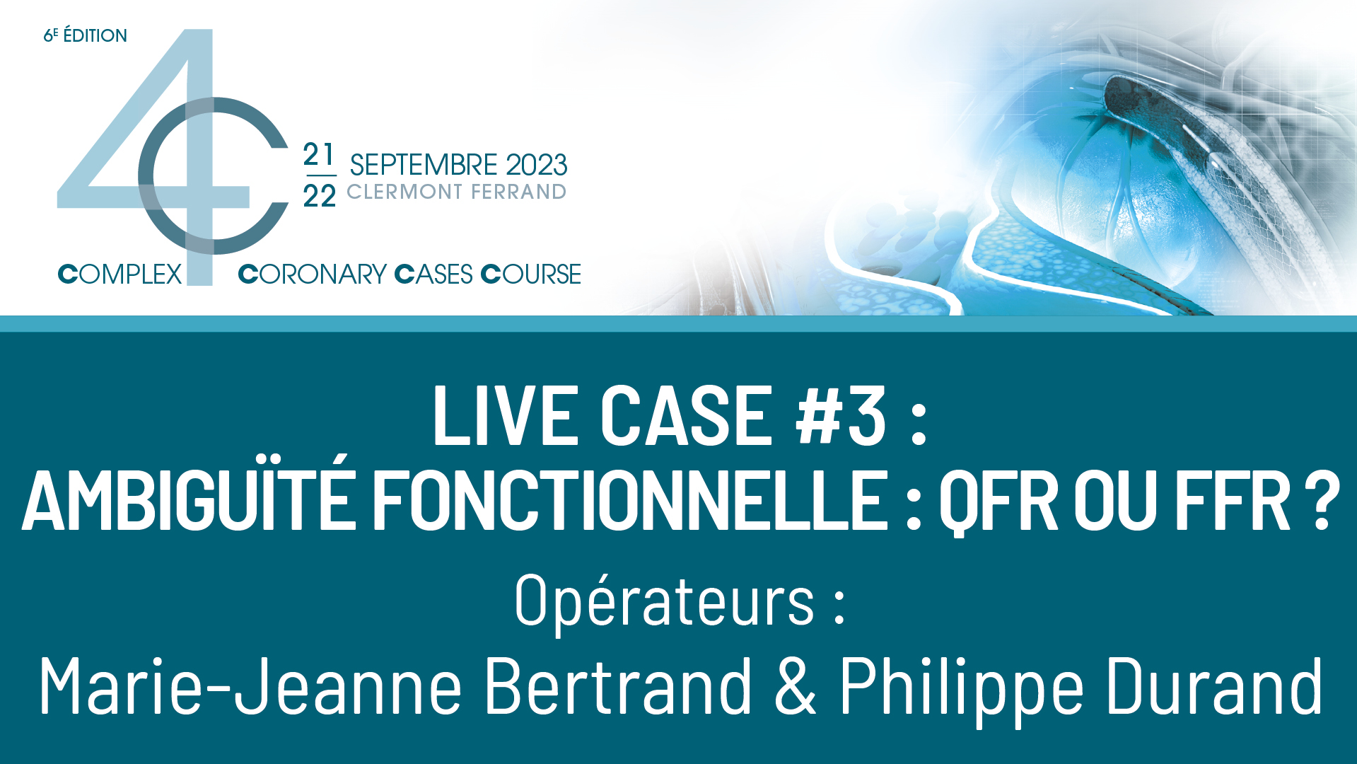 Live case #3 : Ambiguïté fonctionnelle : QFR ou FFR ?